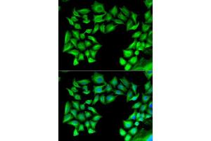 Immunofluorescence analysis of U2OS cells using TIMP4 antibody. (TIMP4 antibody  (AA 30-224))