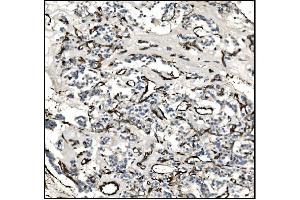 IHC analysis of TAGLN/Transgelin using anti-TAGLN/Transgelin antibody (ABIN7600099). (Transgelin antibody  (AA 15-170))