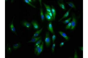 Immunofluorescence staining of Hela cells with ABIN7143601 at 1:133, counter-stained with DAPI. (AGRN antibody  (AA 968-1130))