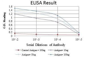 Red: Control Antigen (100 ng), Purple: Antigen (10 ng), Green: Antigen (50 ng), Blue: Antigen (100 ng), (PAX4 antibody)