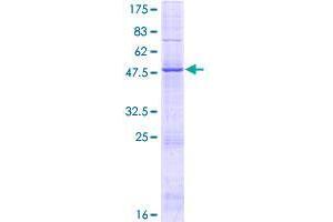 Image no. 1 for Gypsy Retrotransposon Integrase 1 (GIN1) (AA 1-222) protein (GST tag) (ABIN1355105) (GIN1 Protein (AA 1-222) (GST tag))