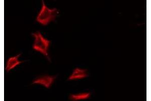 ABIN6275776 staining Hela by IF/ICC. (IL18R1 antibody  (Internal Region))