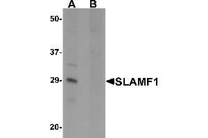 Western blot analysis of SLAMF1 in rat colon tissue lysate with SLAMF1 antibody at 1 µg/mL in (A) the absence and (B) the presence of blocking peptide. (SLAMF1 antibody  (N-Term))