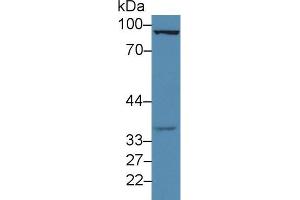 Western blot analysis of Rat Testis lysate, using Rat FOXM1 Antibody (3 µg/ml) and HRP-conjugated Goat Anti-Rabbit antibody (