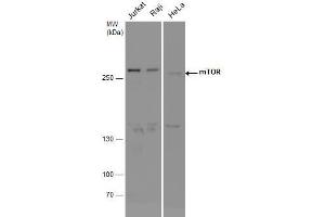 WB Image mTOR antibody detects mTOR protein by western blot analysis. (MTOR antibody  (Internal Region))