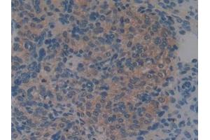 Detection of S100A6 in Mouse Ovary Tissue using Monoclonal Antibody to S100 Calcium Binding Protein A6 (S100A6) (S100A6 antibody  (AA 1-89))