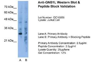 Host:  Rabbit  Target Name:  GNB1L  Sample Type:  Jurkat  Lane A:  Primary Antibody  Lane B:  Primary Antibody + Blocking Peptide  Primary Antibody Concentration:  2. (GNB1L antibody  (C-Term))