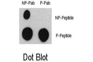 Dot blot analysis of ATF2 (phospho S322) polyclonal antibody  and ATF2 Non Phospho-specific Pab on nitrocellulose membrane. (ATF2 antibody  (pSer322, pSer340))