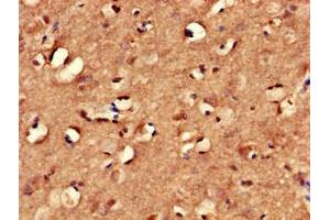 Immunohistochemistry of paraffin-embedded human brain tissue using ABIN7166940 at dilution of 1:100 (MYRIP antibody  (AA 387-689))