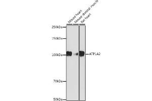 Western Blotting (WB) image for anti-ATPase, Na+/K+ Transporting, alpha 2 Polypeptide (ATP1A2) antibody (ABIN7265769)