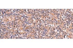 Immunohistochemistry of paraffin-embedded Human tonsil tissue using UBAC1 Polyclonal Antibody at dilution of 1:50(x200) (UBAC1 antibody)