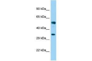 Host: Rabbit Target Name: FAM49B Sample Type: Fetal Brain lysates Antibody Dilution: 1. (FAM49B antibody  (N-Term))