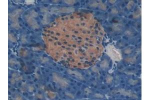 Immunohistochemistry (IHC) image for anti-TIMP Metallopeptidase Inhibitor 4 (TIMP4) (AA 42-224) antibody (ABIN1172385)