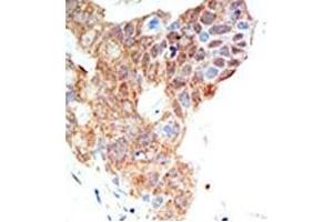 Image no. 2 for anti-Protein Arginine Methyltransferase 5 (PRMT5) (C-Term) antibody (ABIN356529) (PRMT5 antibody  (C-Term))