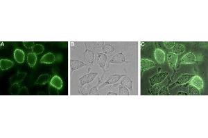 Expression of TROY in human U-87 MG cells - Cell surface detection of TROY in live intact human U-87 MG glioblastoma cells. (TNFRSF19 antibody  (Extracellular))