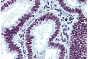 Human Uterus: Formalin-Fixed, Paraffin-Embedded (FFPE) (CDKL1 antibody  (AA 259-358))