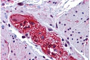 Human Colon, Submucosal Plexus: Formalin-Fixed, Paraffin-Embedded (FFPE) (CABP7 antibody  (N-Term))