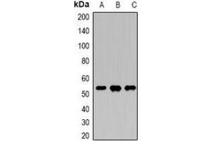 Western blot analysis of DDX39B expression in Hela (A), SKOV3 (B), K562 (C) whole cell lysates. (DDX39B antibody)
