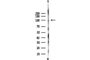 anti-NIMA (Never in Mitosis Gene A)- Related Kinase 9 (NEK9) (Internal Region) antibody