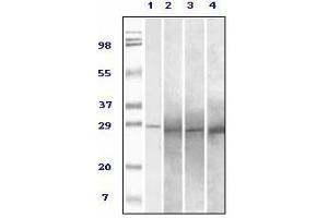 Western Blotting (WB) image for anti-RAB25, Member RAS Oncogene Family (RAB25) antibody (ABIN1108810) (RAB25 antibody)