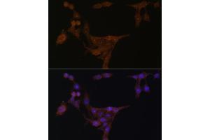 Immunofluorescence analysis of HeLa cells using PPAT Polyclonal Antibody (ABIN6128488, ABIN6146009, ABIN6146010 and ABIN6222409) at dilution of 1:100 (40x lens). (PPAT antibody  (AA 1-280))