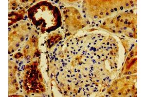 Immunohistochemistry of paraffin-embedded human kidney tissue using ABIN7162672 at dilution of 1:100 (PVALB antibody  (AA 2-110))