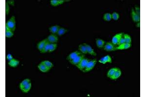 Immunofluorescent analysis of HepG2 cells using ABIN7149938 at dilution of 1:100 and Alexa Fluor 488-congugated AffiniPure Goat Anti-Rabbit IgG(H+L) (DPYD antibody  (AA 5-152))