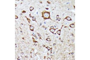 Immunohistochemistry of paraffin-embedded mouse spinal cord using BNIP1 Rabbit mAb (ABIN7265867) at dilution of 1:100 (40x lens). (BNIP1 antibody)