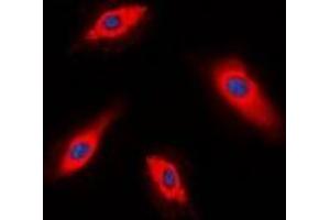 Immunofluorescent analysis of ALPK1 staining in HepG2 cells.