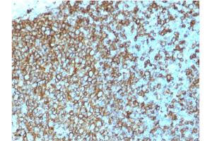Formalin-fixed, paraffin-embedded human Tonsil stained with HLA-Pan Mouse Recombinant Monoclonal Antibody (rHLA-Pan/3475). (Recombinant MHC Class II HLA-DP/DQ/DR antibody)