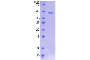 SDS-PAGE (SDS) image for Solute Carrier Family 44, Member 1 (SLC44A1) (AA 74-183) protein (His tag,GST tag) (ABIN4988909) (SLC44A1 Protein (AA 74-183) (His tag,GST tag))