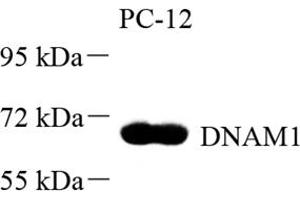 Western blot analysis of DNAM1 (ABIN7073379) at dilution of 1: 500 (CD226 antibody)