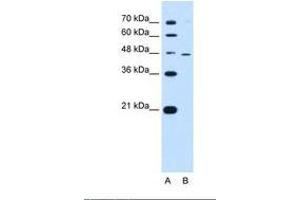 Image no. 2 for anti-Ring Finger Protein 25 (RNF25) (AA 201-250) antibody (ABIN6738069) (RNF25 antibody  (AA 201-250))