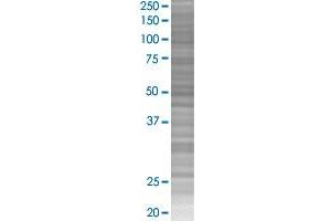 GSTM5 transfected lysate. (GSTM5 293T Cell Transient Overexpression Lysate(Denatured))