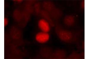 Immunofluorescence staining of manthanol-fixed MCF-7 cells using FOXO1 (phospho S256) polyclonal antibody . (FOXO1 antibody  (pSer256))