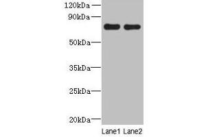 Western blot All lanes: ACTR8 antibody at 16 μg/mL Lane 1: A549 whole cell lysate Lane 2: HCT116 whole cell lysate Secondary Goat polyclonal to rabbit IgG at 1/10000 dilution Predicted band size: 71, 59, 37 kDa Observed band size: 71 kDa