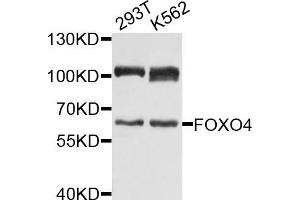 Western blot analysis of extracts of various cell lines, using FOXO4 antibody (ABIN5971698) at 1/1000 dilution. (FOXO4 antibody)