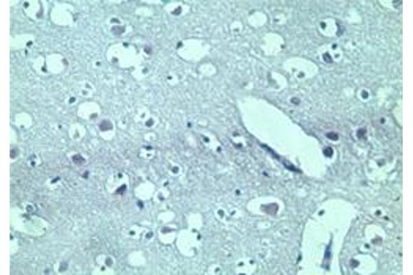 TARBP2 antibody  (AA 340-390)