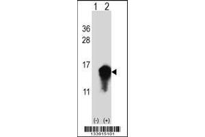 Western blot analysis of CSTA using rabbit polyclonal CSTA Antibody using 293 cell lysates (2 ug/lane) either nontransfected (Lane 1) or transiently transfected (Lane 2) with the CSTA gene. (CSTA antibody  (C-Term))