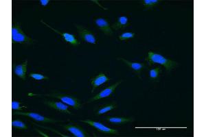 Immunofluorescence of monoclonal antibody to USP47 on HeLa cell. (USP47 antibody  (AA 203-301))