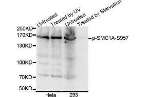 Western Blotting (WB) image for anti-Structural Maintenance of Chromosomes 1A (SMC1A) (pSer957) antibody (ABIN3019554) (SMC1A antibody  (pSer957))