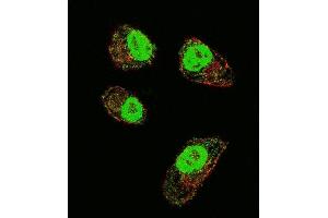 Confocal immunofluorescent analysis of HIF1Alpha Antibody (Center) (ABIN652389 and ABIN2841889) with MDA-M cell followed by Alexa Fluor 488-conjugated goat anti-rabbit lgG (green). (HIF1A antibody  (AA 519-547))