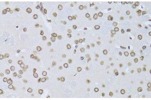 Immunohistochemistry (Paraffin-embedded Sections) (IHC (p)) image for anti-Lamin B2 (LMNB2) antibody (ABIN7262334)