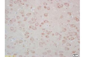 Immunohistochemistry (Paraffin-embedded Sections) (IHC (p)) image for anti-Frizzled Family Receptor 3 (FZD3) (AA 121-220) antibody (ABIN1714171)