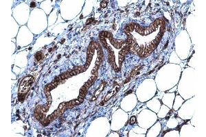IHC-P Image SLC20A1 antibody [N3C2], Internal detects SLC20A1 protein at membrane and cytoplasm on mouse mammary gland by immunohistochemical analysis. (SLC20A1 antibody)