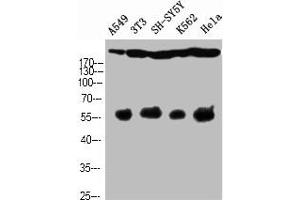 Western Blot analysis of A549 NIH-3T3 SH-SY5Y K562 HELA cells using Cleaved-Notch 4 (V1432) Polyclonal Antibody (NOTCH4 antibody  (Cleaved-Val1432))