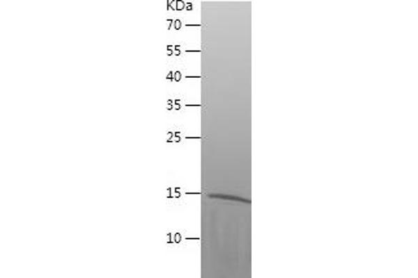 CST3 Protein (AA 29-146) (His tag)