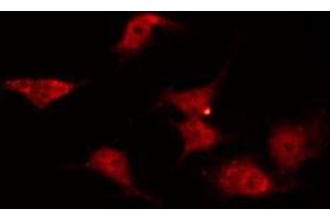 ABIN6272371 staining COLO205 by IF/ICC. (OR2C3 antibody)