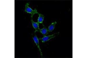 Immunofluorescence analysis of A549 cells using FAK mouse mAb (green). (FAK antibody)
