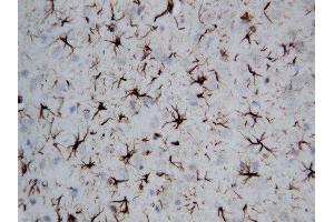 Anti-GFAP antibody, IHC(P) IHC(P): Rat Brain Tissue